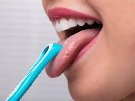 舌汚れの確認と対処方法