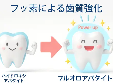 歯質の強化